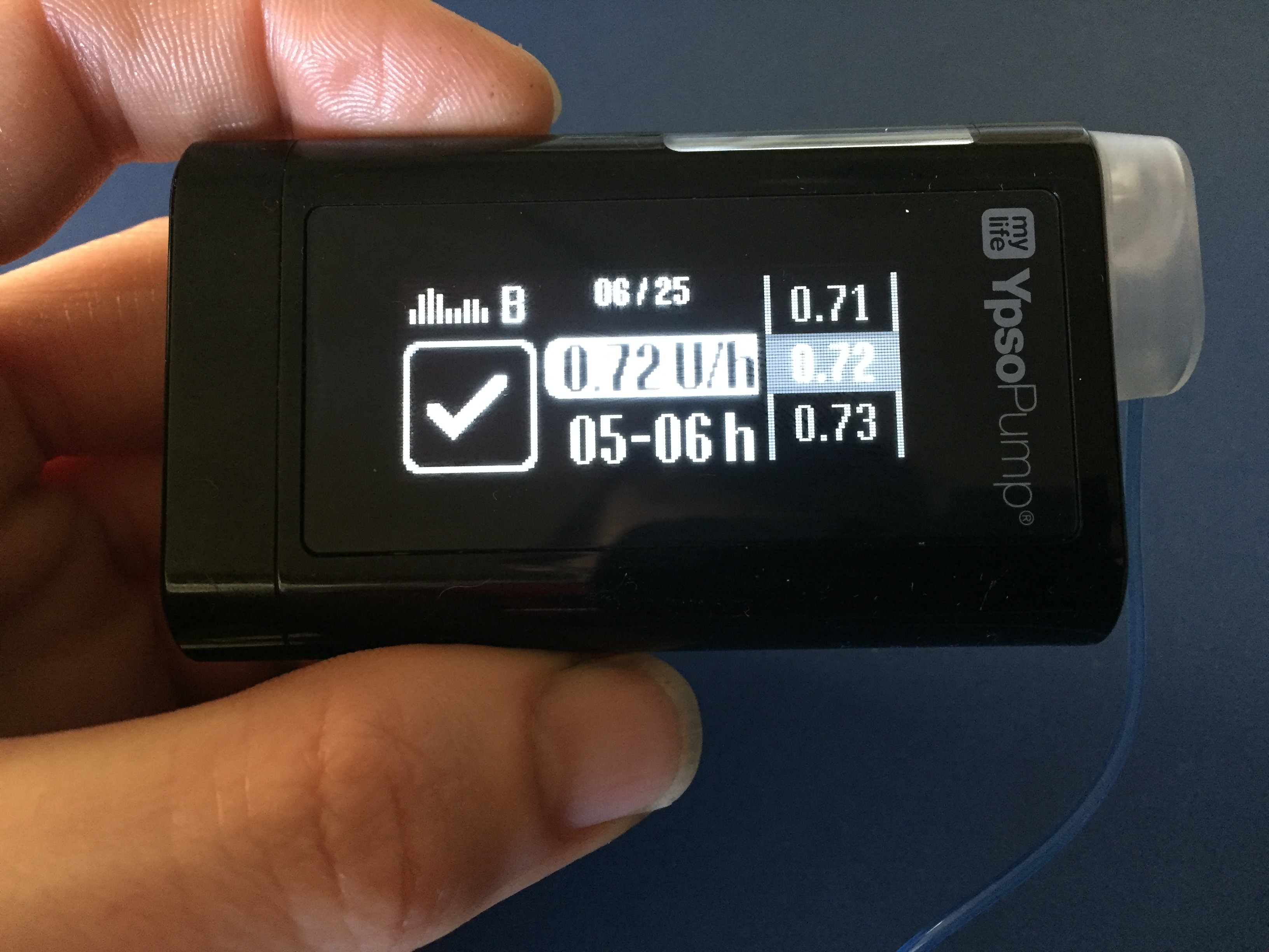 Rate Intuitive Basal Rate Intuition. - Type 1 Writes - Diabetes Blog